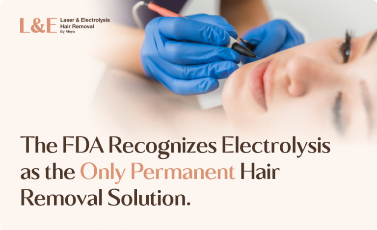 Is Electrolysis Permanent? [+ Key Preparation]